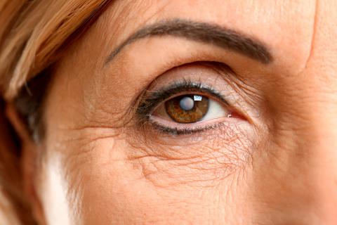 Cómo Prevenir y Tratar las Cataratas de Forma Natural